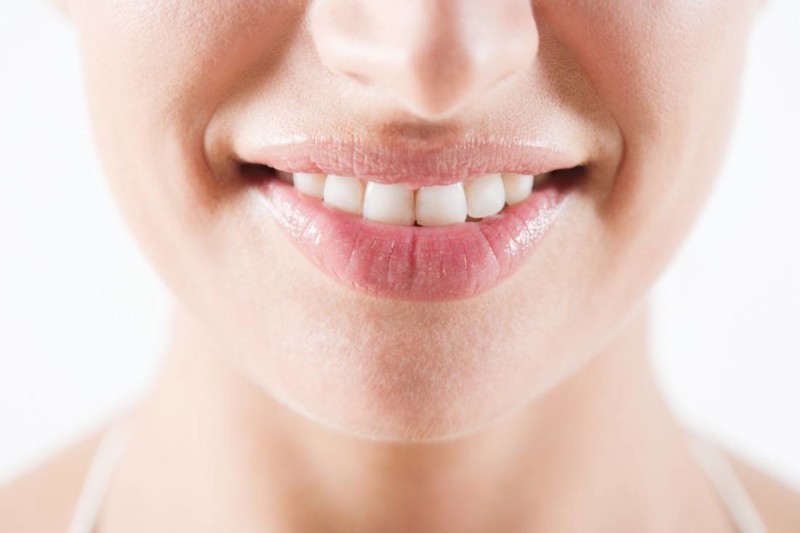 Tipps und Hausmittel zum Zähne aufhellen