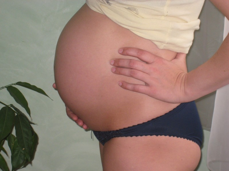 9 Hausmittel gegen Schwangerschaftsstreifen