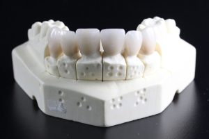 Zahngesundheit schützen